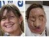 2011-06-13T101423Z_01_BTRE75C0SG200_RTROPTP_2_FACE-TRANSPLANT-CHIMPANZEE[1].jpg