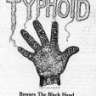 Typhoid