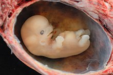 220px-Human_Embryo_-_Approximately_8_weeks_estimated_gestational_age.jpg