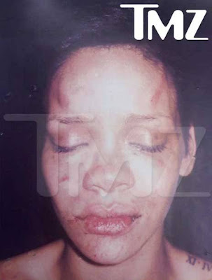 Battered-photo-of-Rihanna-leaked-TMZ.jpg