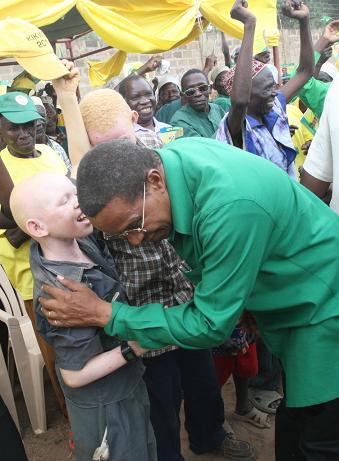 kikwete+albino.jpg