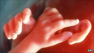 _50225963_p680194-ear_&_hands_of_a_male_foetus_aged_20_week-spl.jpg