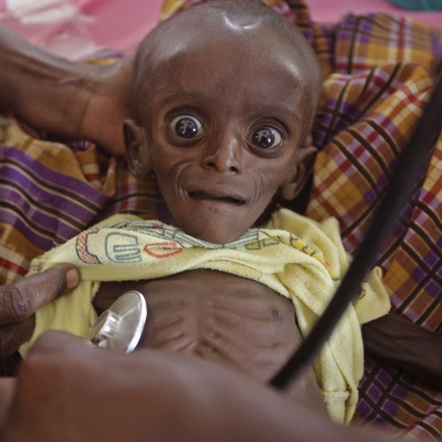 Starving-Somali-Child-AP.jpg