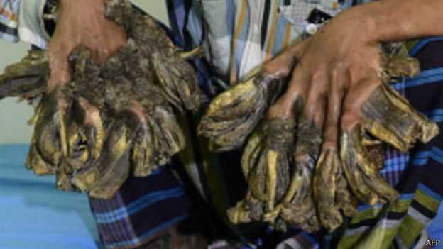 160205050541_abdul_bajandar_tree_512x288_afp.jpg