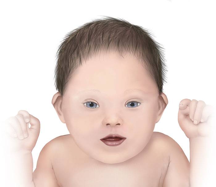 down-syndrome-illustration.jpg
