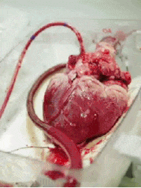 JamiiForums565945500.gif