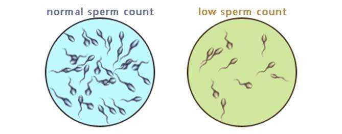LOW SPERM COUNT.jpg