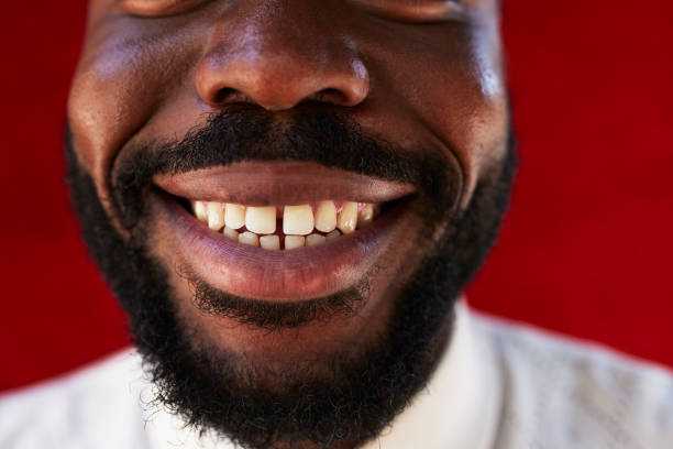 mouth.jpg