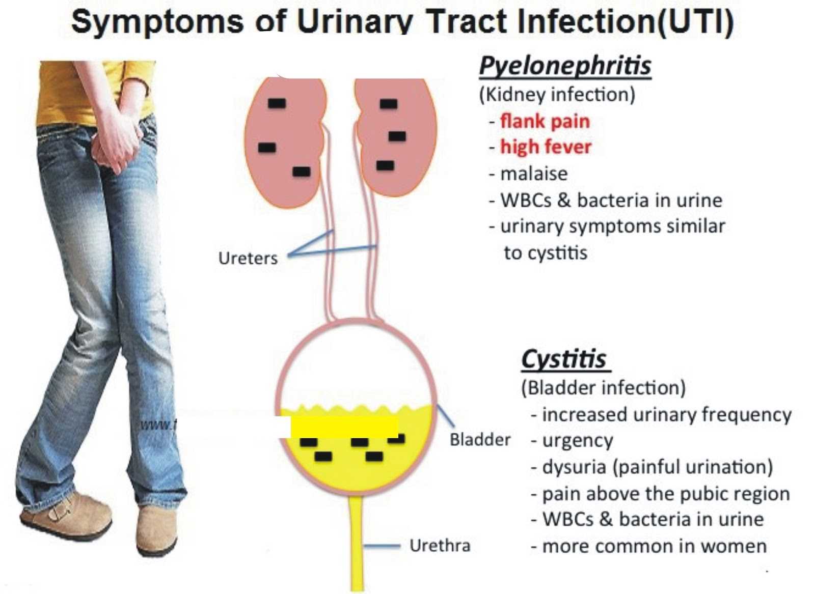 UTI.jpg