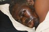 MAJERUHI-TINDIKALI-IGUNGA-2.jpg MAJERUHI-TINDIKALI-IGUNGA-2.jpg