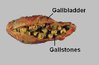 gallbladder2.jpg