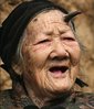 chinese-woman-grows-horn-6.jpg