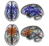 sex-differences-brain.jpg1386013355.jpg