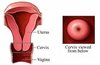 cervix.jpg