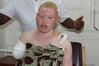Albinooo.jpg