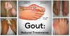 the-gout-remedy-report-can.jpg