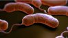 150709083228_cholera_bacteria_624x351_bbc_nocredit.jpg