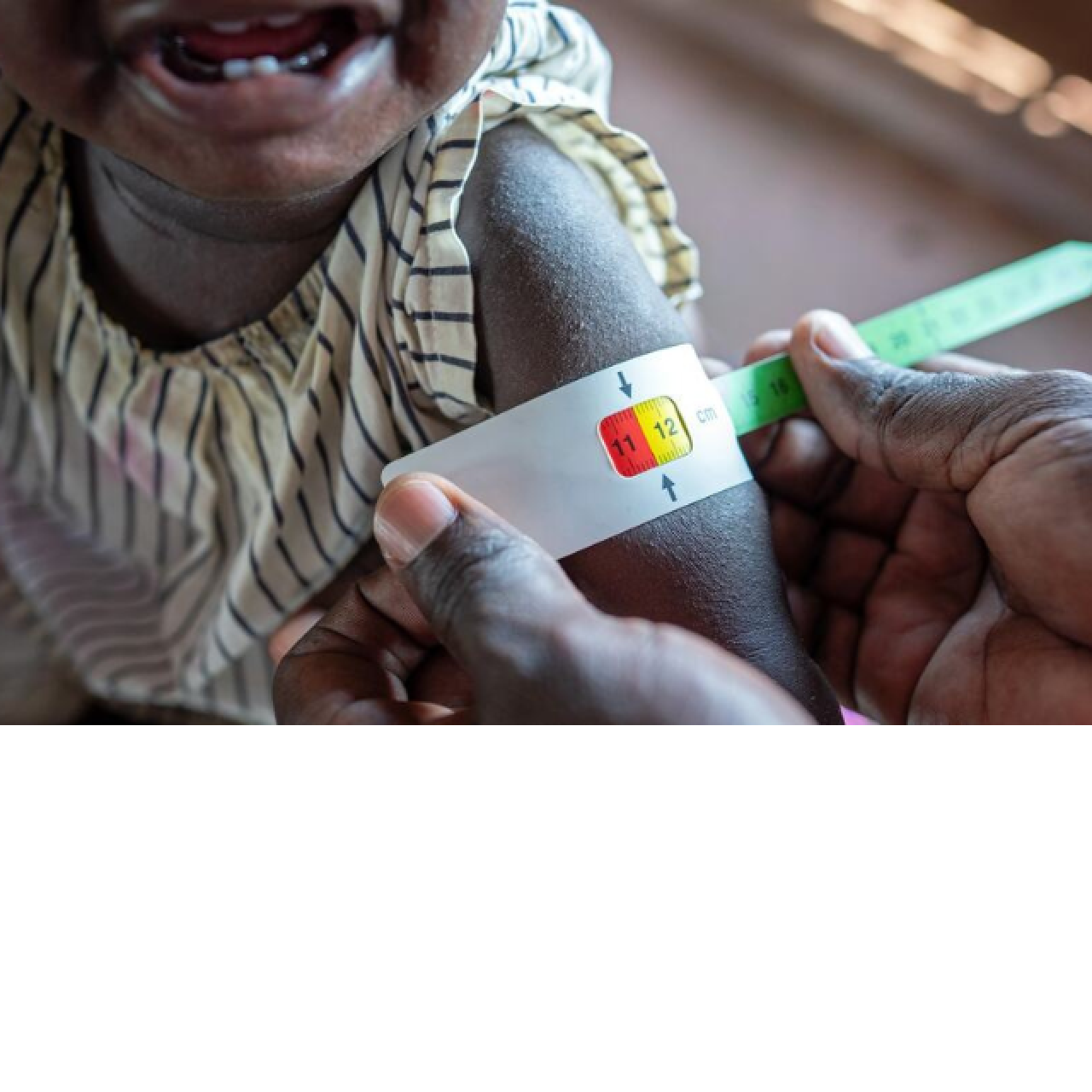 Dunia inazalisha Chakula cha kutosha, lakini Afrika bado njaa ni kubwa. Tatizo ni nini?