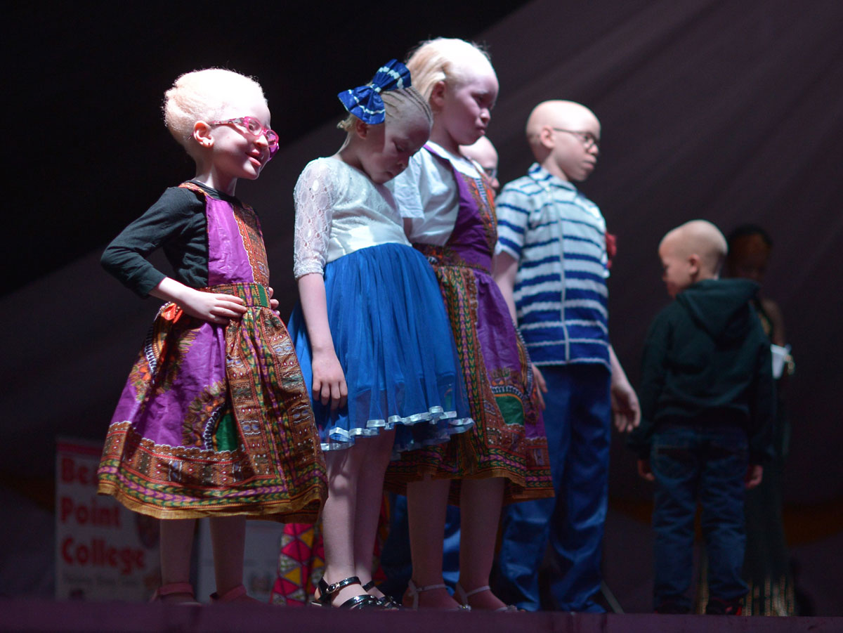 AFP-Getty_KENYA-DISABLED-PEOPLE-HEALTH-ALBINO2-1.jpg