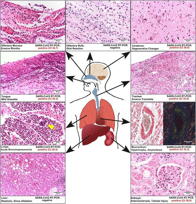 postmortem-tissue-images-1.jpg