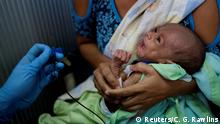 Venezuela Mangelernährung Kinder