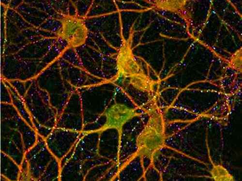 neurons_brain.JPG