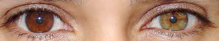 human-chimera-brown-hazel-eyes.jpg