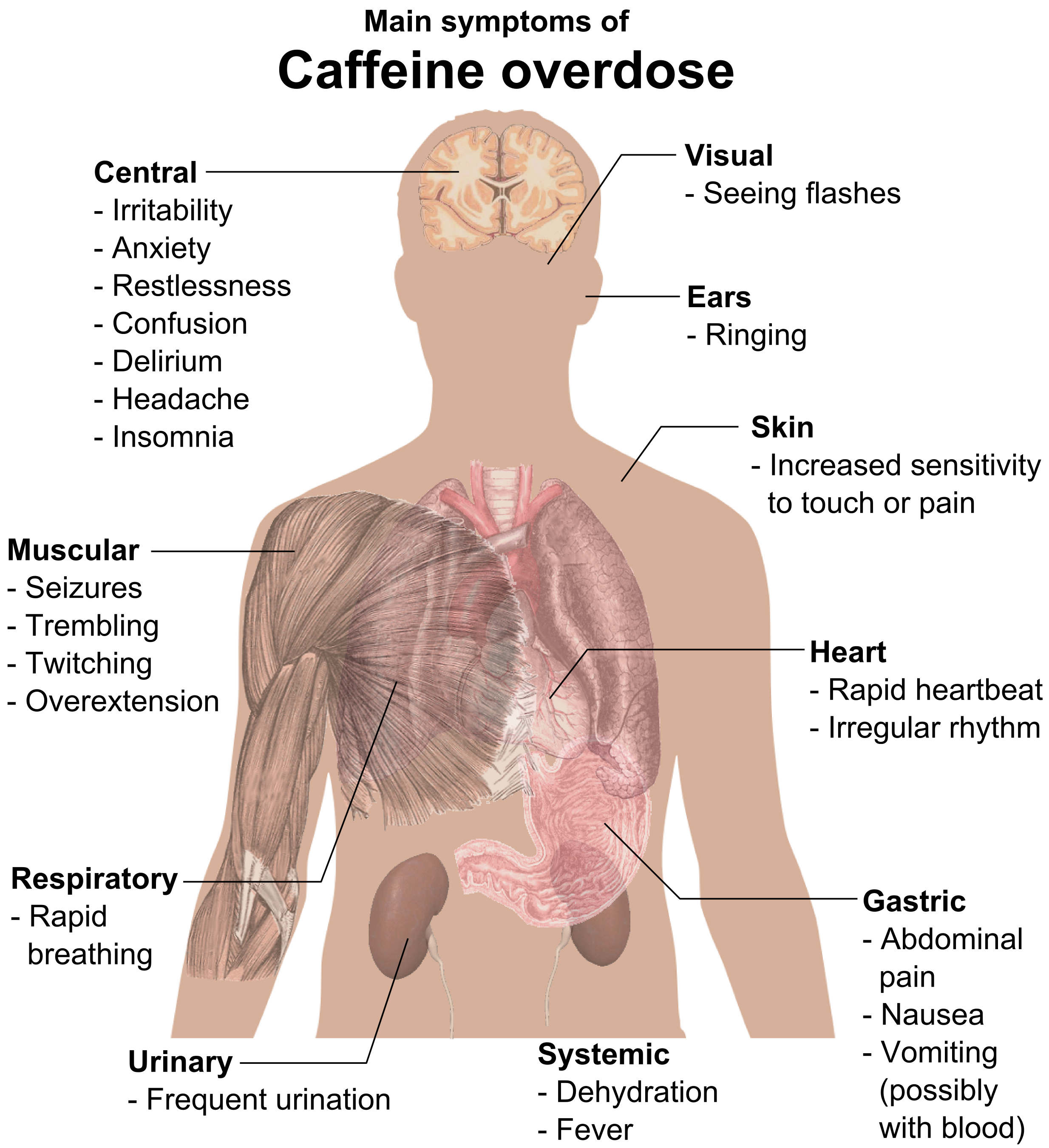 Main_symptoms_of_Caffeine_overdose.png
