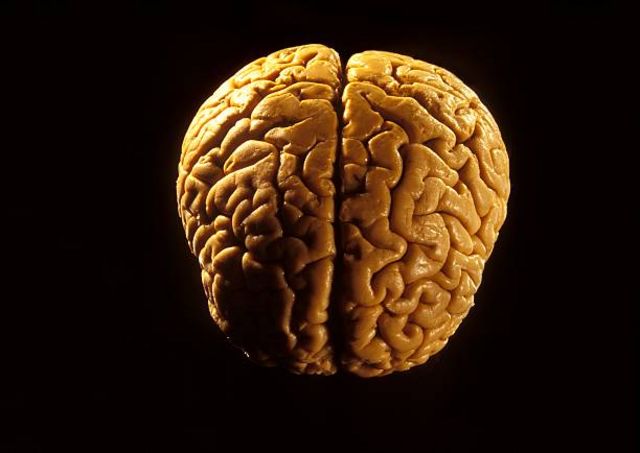 brain