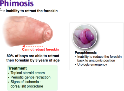 Phimosis Na Paraphimosis.