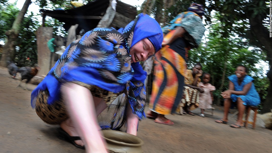 170613094608-ukerewe-tanzania-albino-getty-6-super-169.jpg