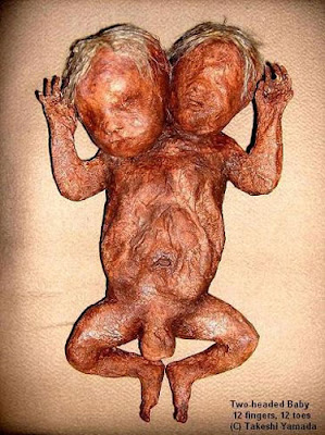 two-headed-baby.jpg