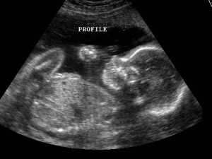 2d_ultrasound3.jpg