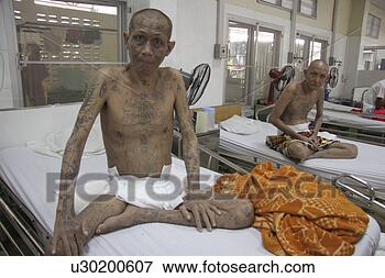 aids-person-patients_~u30200607.jpg