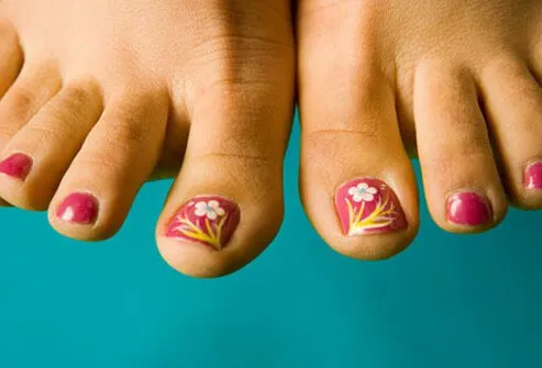 lose-weight-without-dieting-s24-womans-painted-toenails.jpg