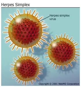 genital_herpes-1.jpg