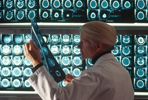 princ_rm_photo_of_doctor_examining_mri_for_stroke_damage.jpg