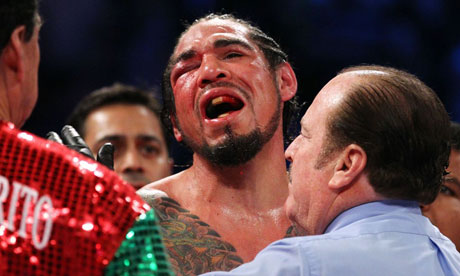 Antonio-Margarito-loses-t-007.jpg