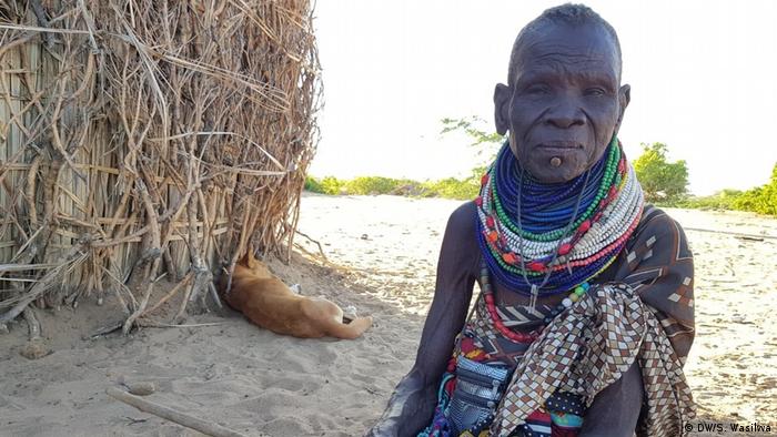 Kenia Turkana | Unterernährung